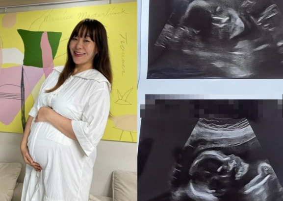 Comedian Jung Juri Reveals Ultrasound of Her Fifth Son on Instagram, Sparking Joyful Reactions from Fans and Friends