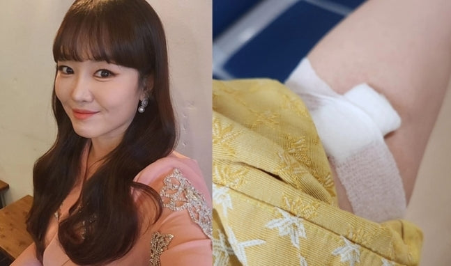 Singer Jeong Mi-ae Shares Emotional Update on Health Struggles After Cancer Battle