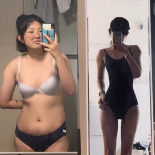 Influencer Choi Jun-hee Denies Liposuction Rumors, Shares Personal Struggles with Skin and Weight Loss Journey - OUR K-POP