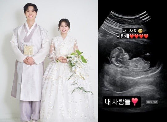 Musical Actor Won-hyuk Shares Excitement of Fatherhood with Adorable Ultrasound Image of Expecting Baby - OUR K-POP